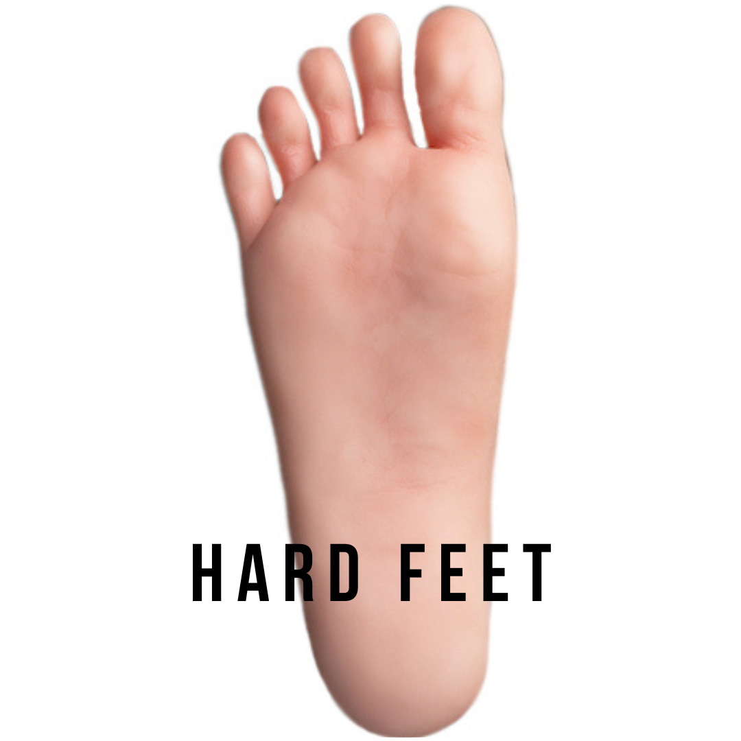 hard-feet